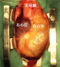 正中切開による術野