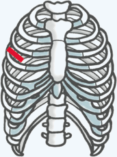 肋骨のすき間から手術