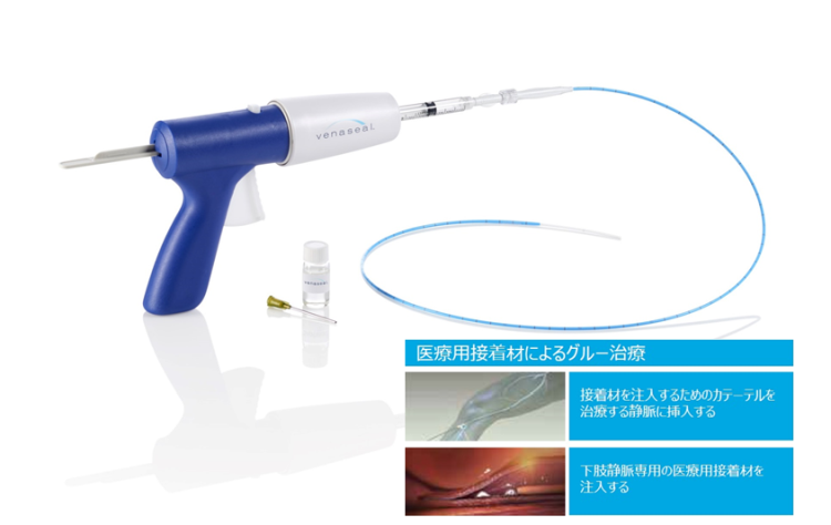 医療用接着剤によるグルー治療