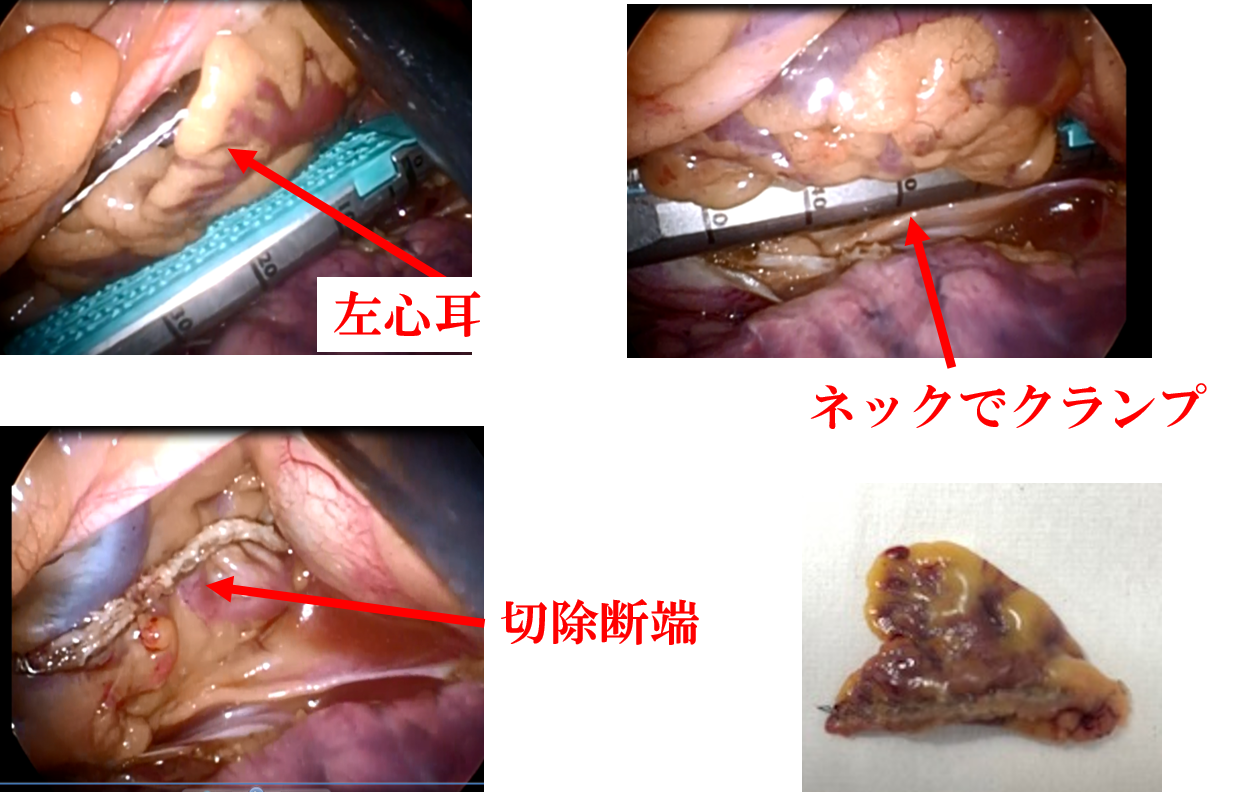 手術中の写真