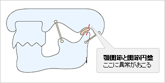 顎関節と関節円盤