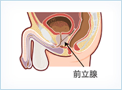 前立腺